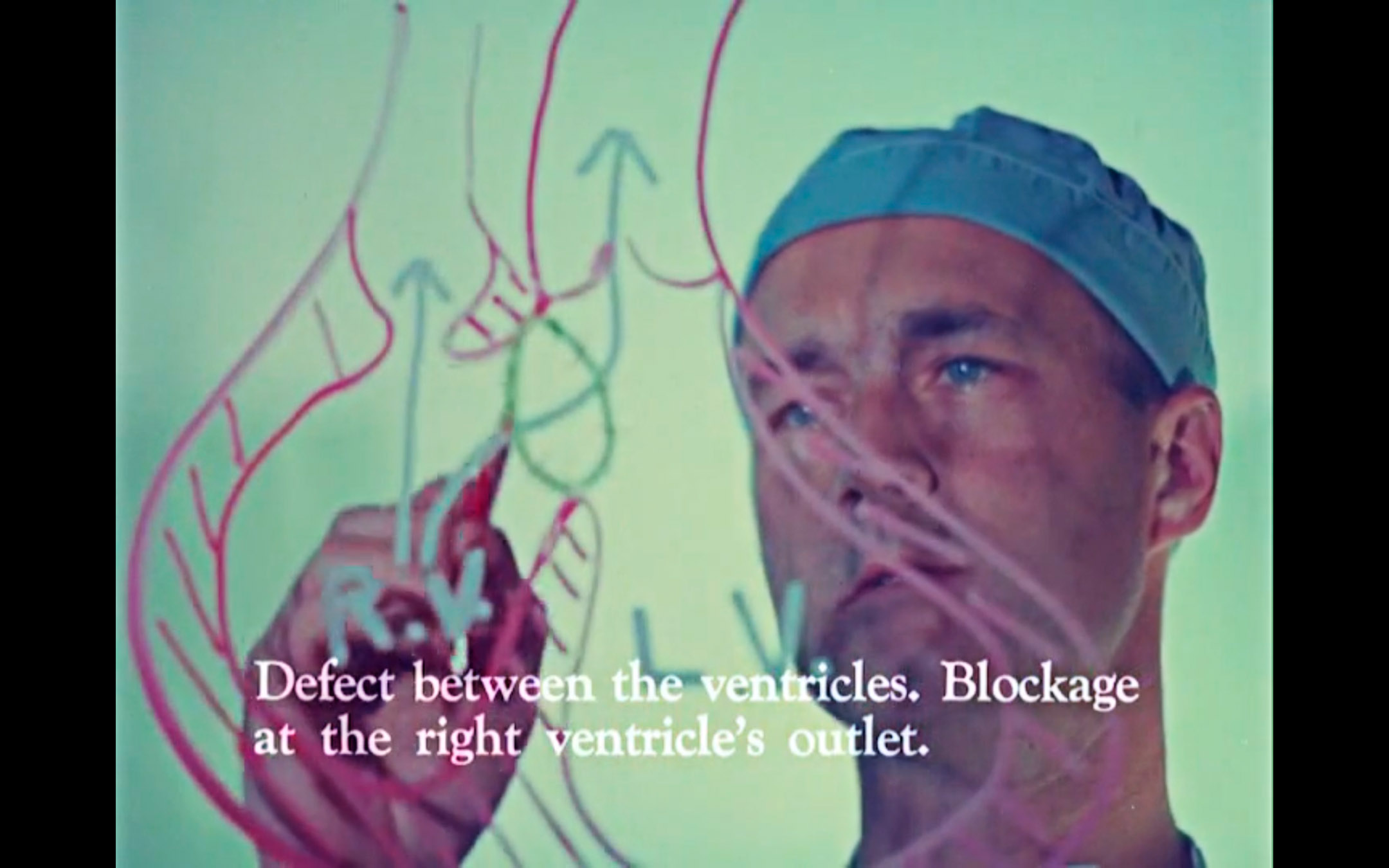 Still of Anthony Dobell discussing open heart surgical procedure from Robert Cordier's Miracles in Modern Medicine
