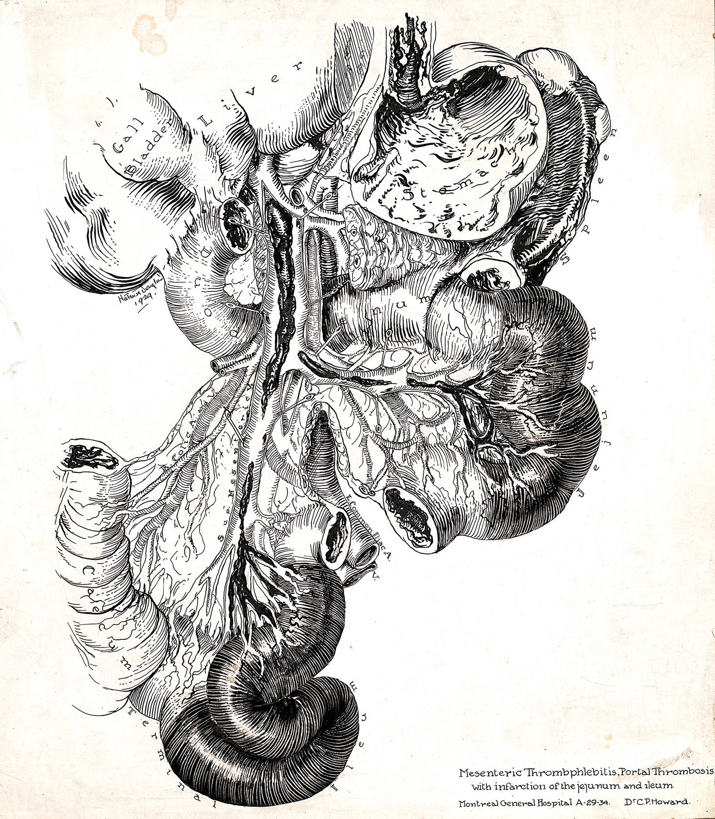 pen drawing of viscera